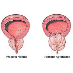 Próstata