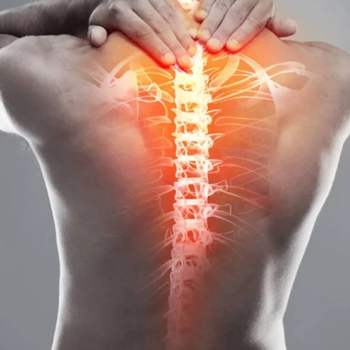 Harpagofito y dieta: reduce la inflamacion que agrava tu espalda