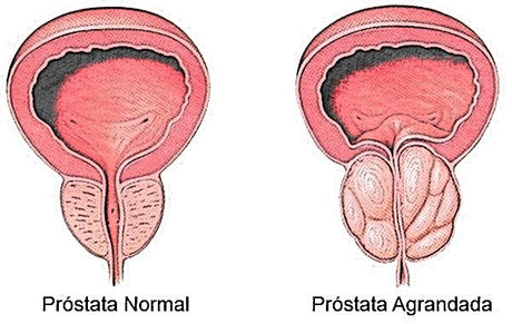 Próstata