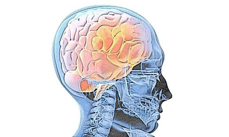 Trastornos neurológicos