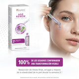Age Renew Super Serum · Himalaya · 30 ml